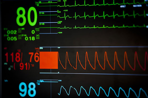 Vital Signs on an ICU Monitor